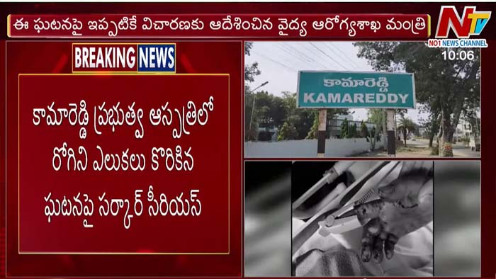 Government Is Serious About The Incident Of Rats Biting A Patient In Kamareddy Government Hospital