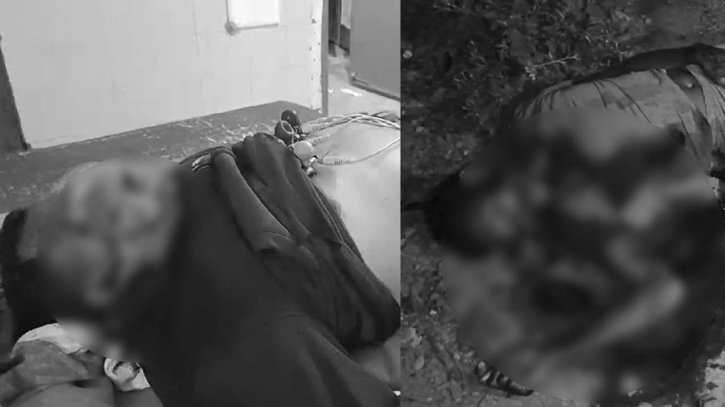 Maoists Attack Panchayati Secretary Mulugu District