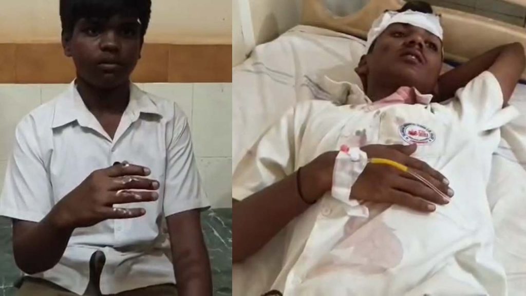 Gurukul School Building Collapse Lingampalli Sangareddy Telangana News Students Safety School Infrastructure Accident News