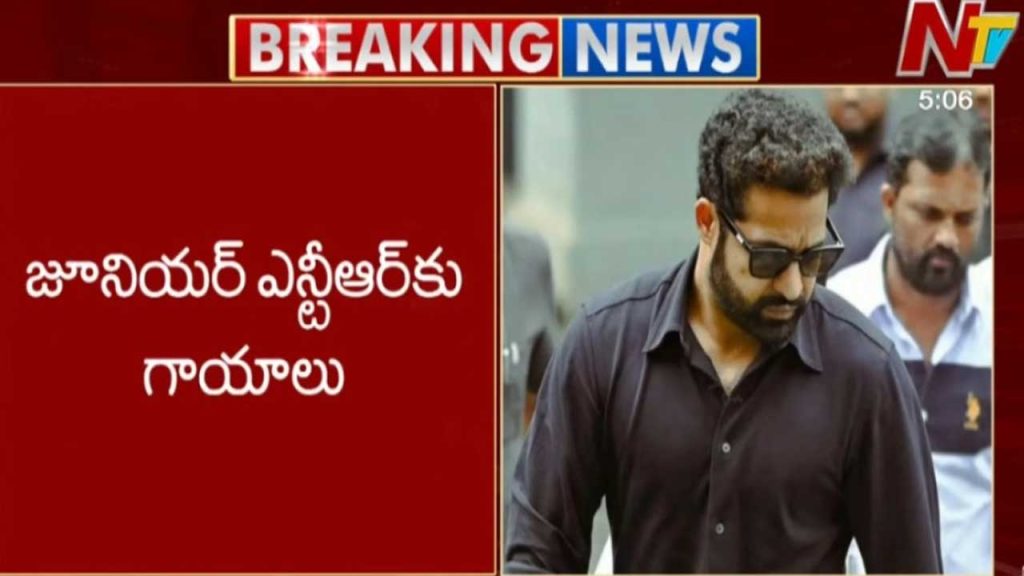 Jr Ntr Injured In Ad Shoot Accident In Hyderabad Minor Injuries Reported Fans Express Concern