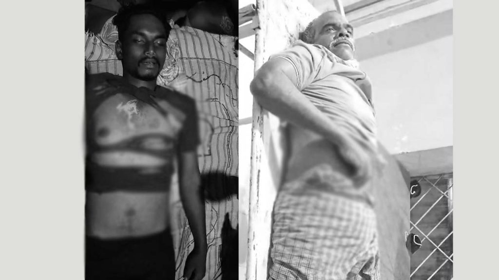 Many People Died Due To Lightning Strikes In Telangana