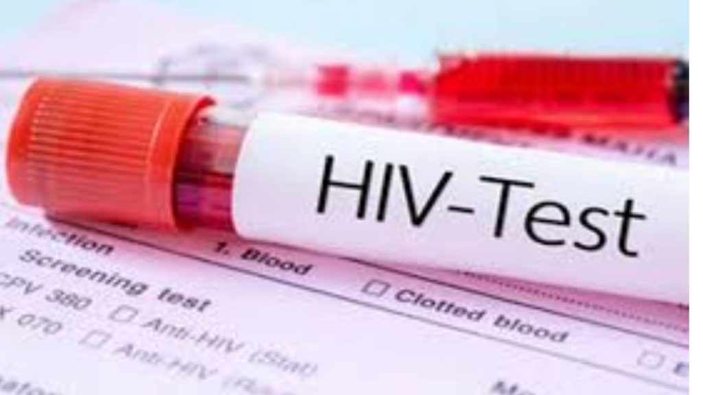 Ramagundam Industrial Area Sees Rising Hiv Cases Art Center Reports 100 New Patients Monthly