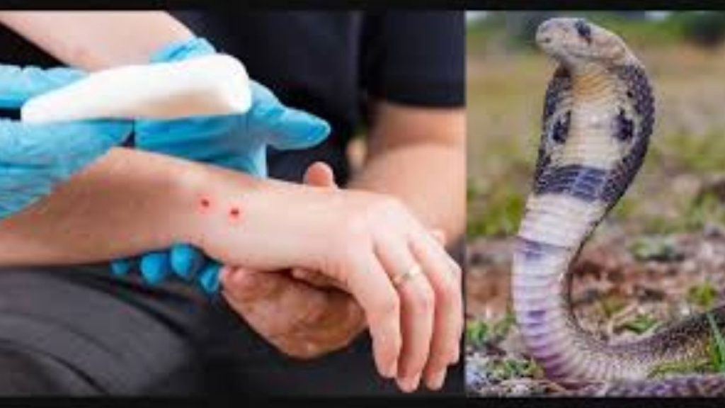 Snake Bite Essential First Aid Tips To Stay Safe And Calm After A Snake Bite