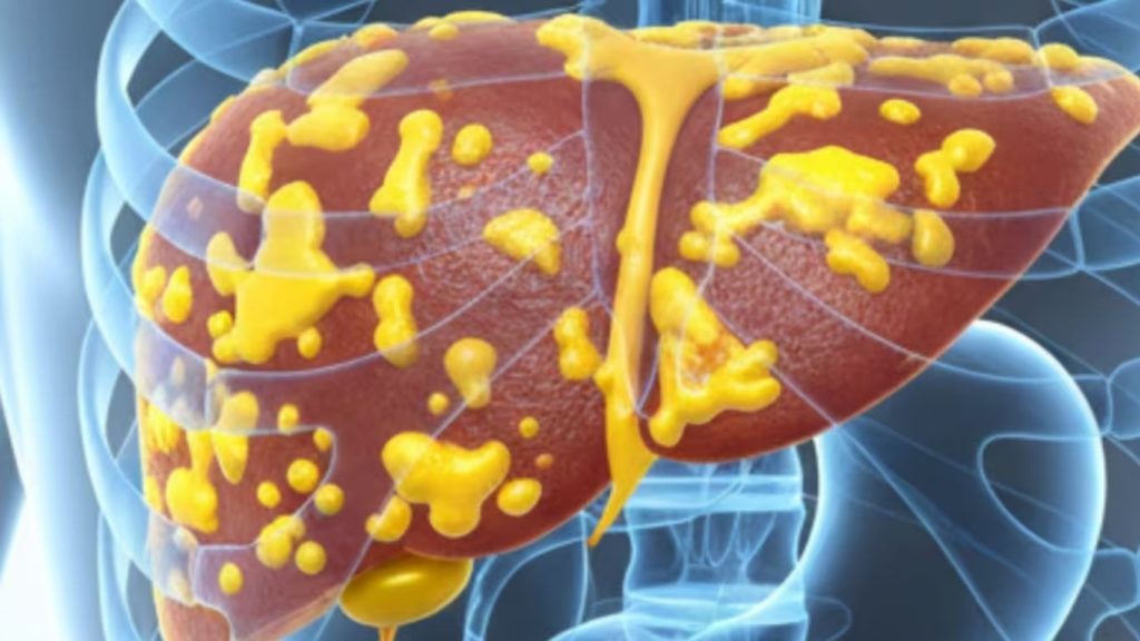 Natural Liver Detox Through Dry Fasting And Autophagy Simple Ways To Cleanse Liver Naturally