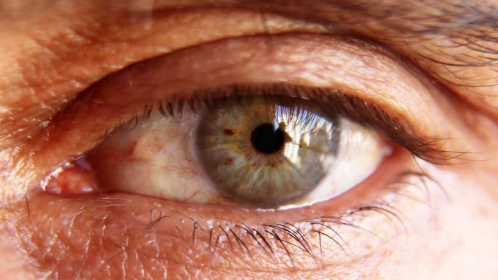 Winter Eye Care Problems Tips Dry Eyes Infections
