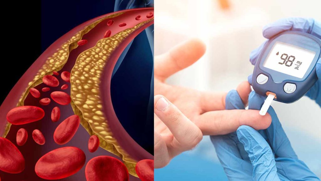 Eye Symptoms That Signal Diabetes High Cholesterol Early Warning Signs Without Tests