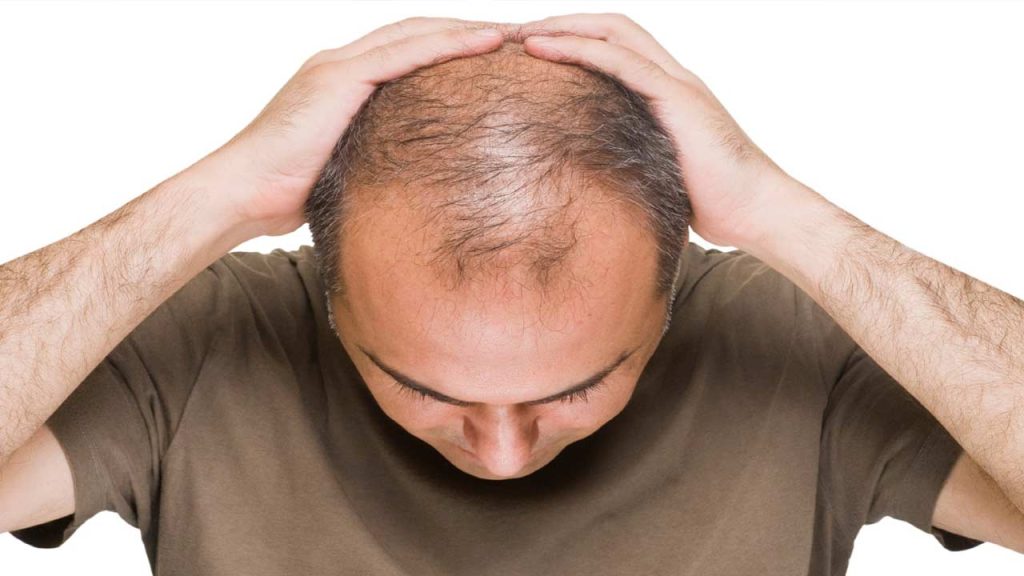 Hair Fall: వీటికి దూరంగా ఉండండి బాస్.. లేదంటే జుట్టు హుష్‌కాక్!