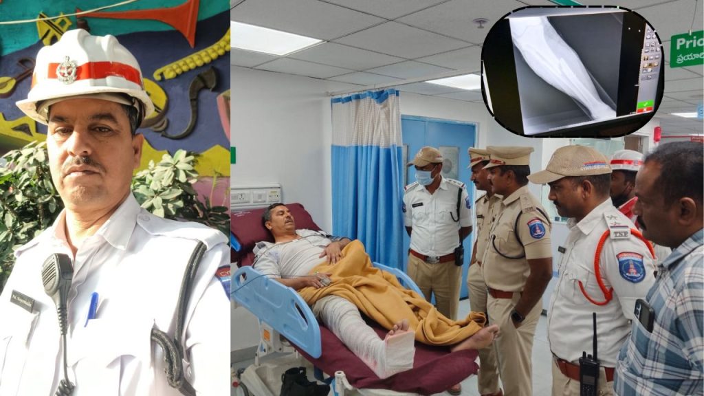 Hit And Run In Madhapur Traffic Home Guard Injured After Speeding Car Flees Scene