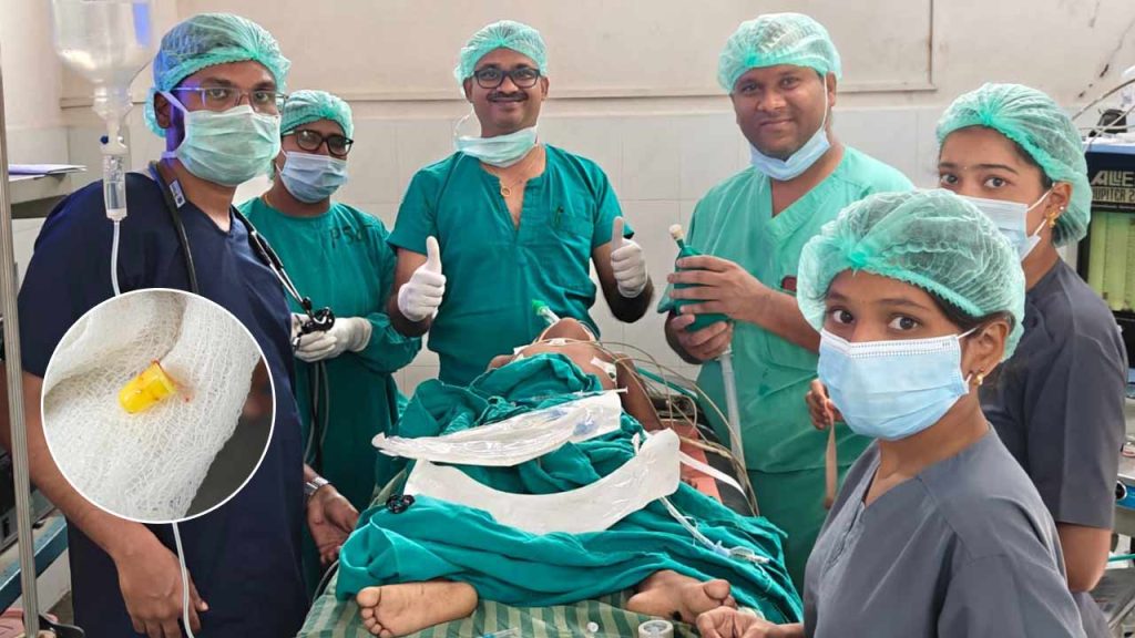 Rare Surgery Successfully Performed At Ruia Hospital Tirupati Plastic Cap Removed From 3 Year Olds Lungs