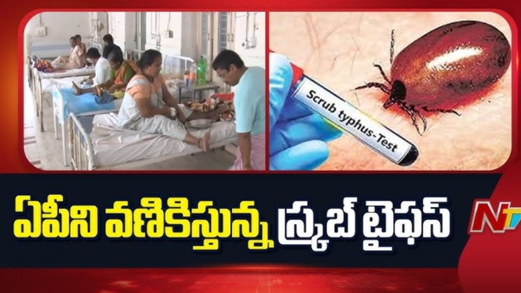 Scrub Typhus In Andhra Pradesh Health Dept Clarifies No Need For Panic