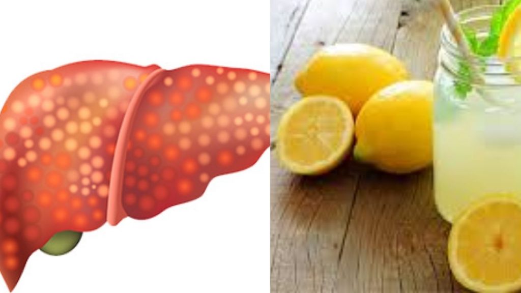 Fatty Liver Causes Symptoms And Benefits Of Lemon Water For Liver Health