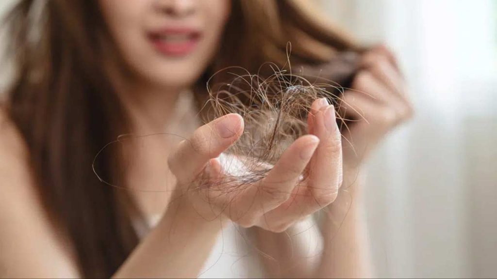 Hair Care Reasons For Excessive Hair Fall Nutrient Deficiency