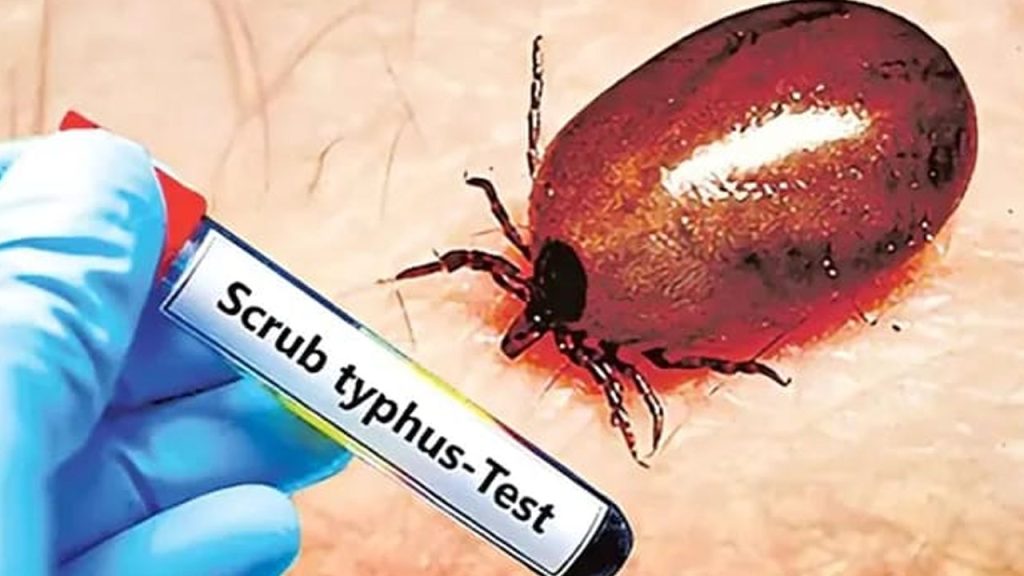 Scrub Typhus Outbreak Palnadu Two Deaths Symptoms Treatment News