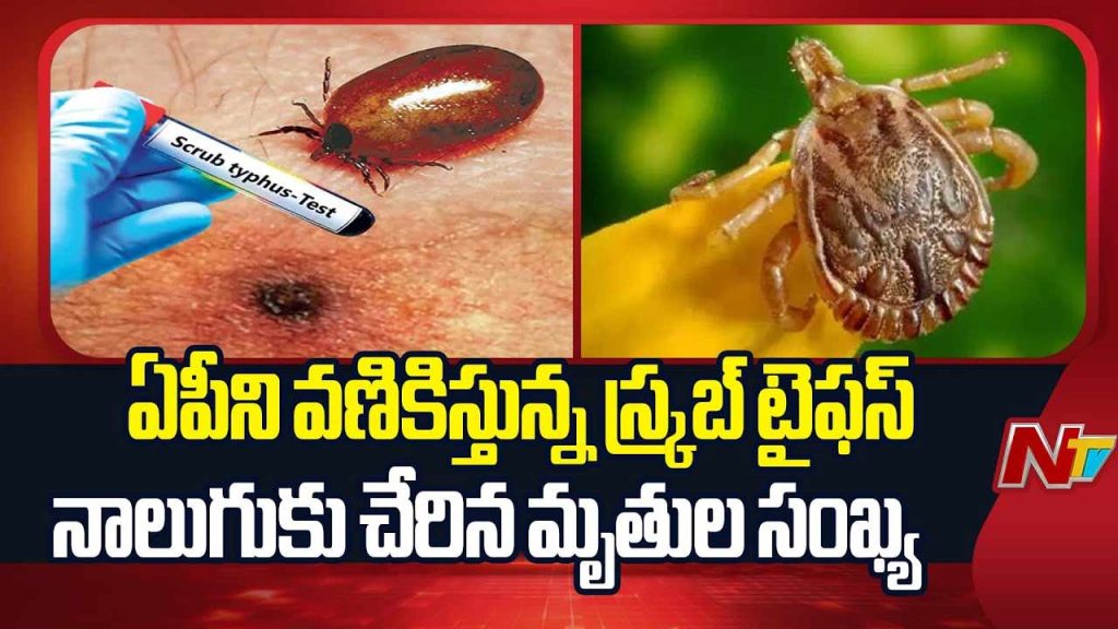 Scrub Typhus Ravaging Andhra Pradesh Deaths