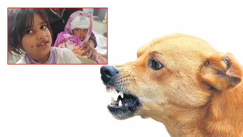 8 Year Old Girl Fights Street Dog To Save Her 5 Year Old Brother Uses Her T Shirt To Stop His Bleeding