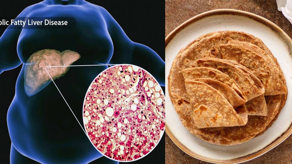 Fatty Liver Diet Wheat Roti Millets