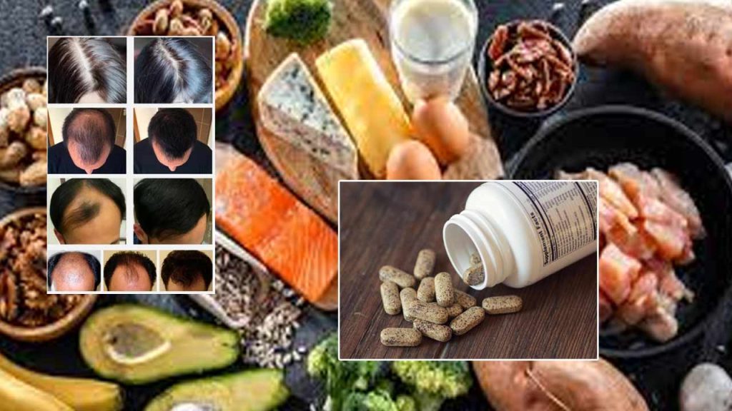 Biotin For Hair Loss Does Vitamin B7 Really Help Hair Growth