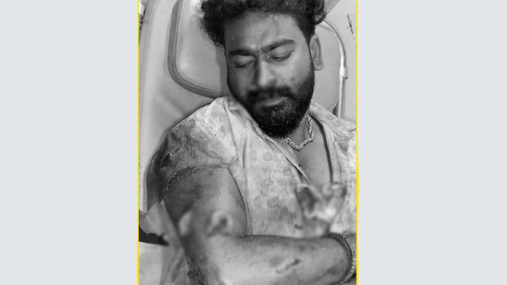 Young Man Young Womandaughter Love Yadadri Bhuvanagiri Telangana