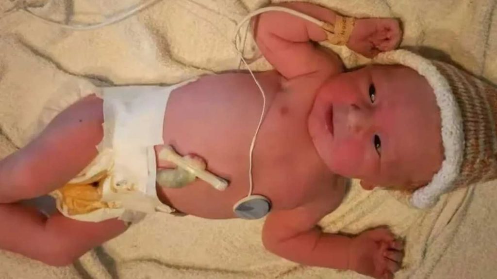 Medical Miracle Umbilical Cord Amniotic Membrane Healing Benefits