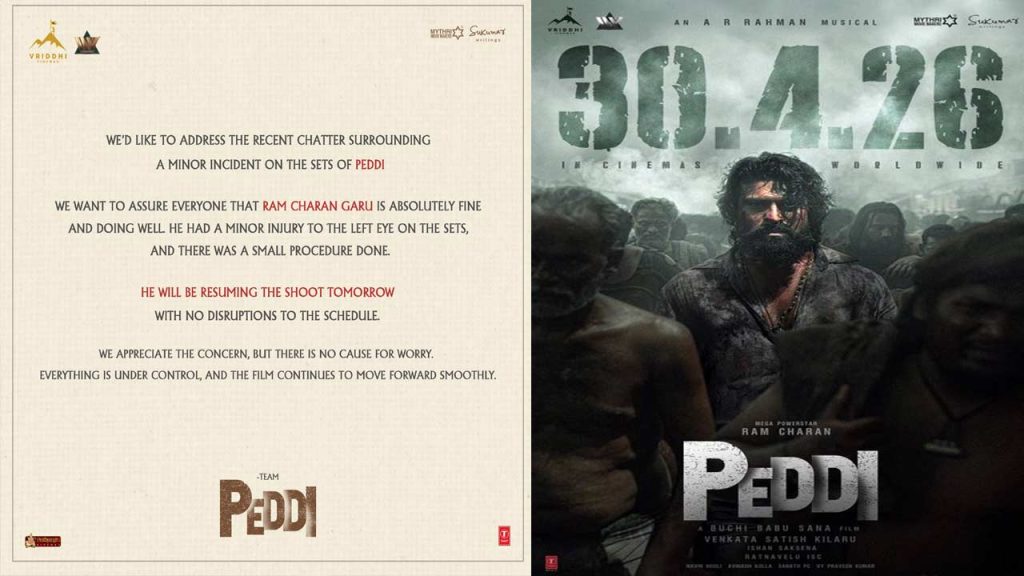 Ram Charan Peddi Movie Shooting Injury Update Official Statement