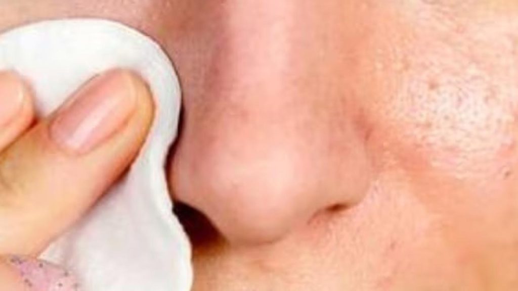 Home Tips To Reduce Dark Spots On Face And Make It Brighter