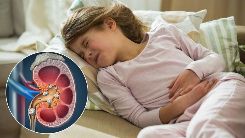 Kidney Stones In Children Causes Symptoms Prevention