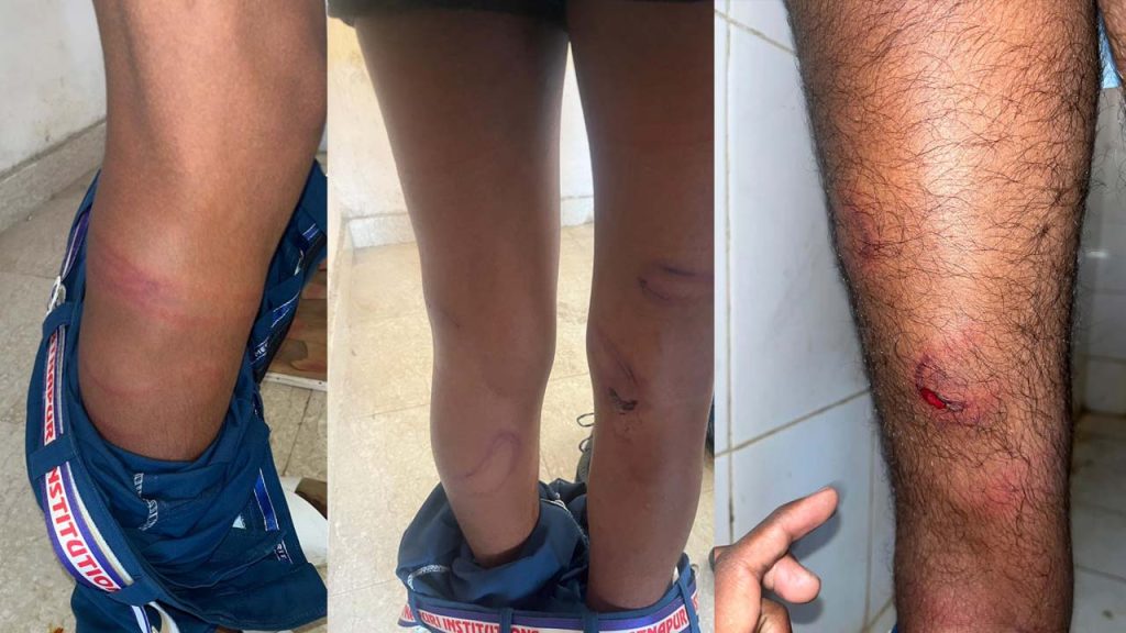 Sangareddy Polytechnic Students Beaten By Hod