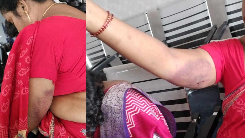 Land Dispute Turns Violent Five Women Brutally Attacked In Bheemunipatnam