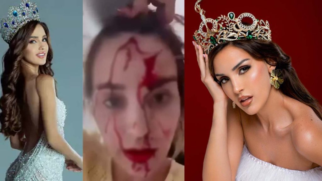 Cannes Film Festival Miss Venezuela Andrea Del Val Attacked By Stylist