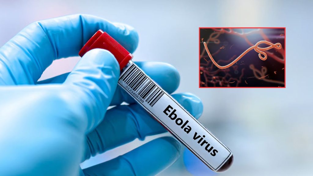 Andhra Pradesh Government On High Alert Over Ebola Virus Threat Special Screening At Airports