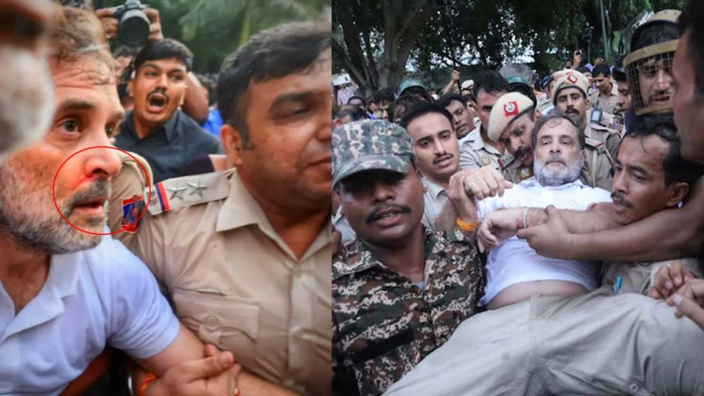 Rahul Gandhi Detained Delhi Pm Residence Protest Nose Injury Congress Neet Protest