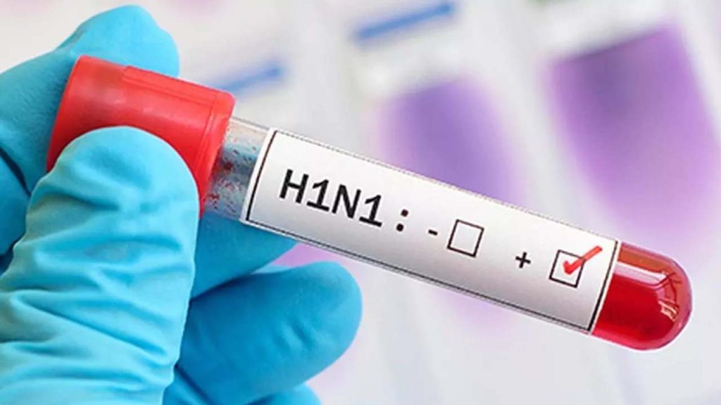 Delhi Swine Flu H1n1 Cases Surge Symptoms Treatment