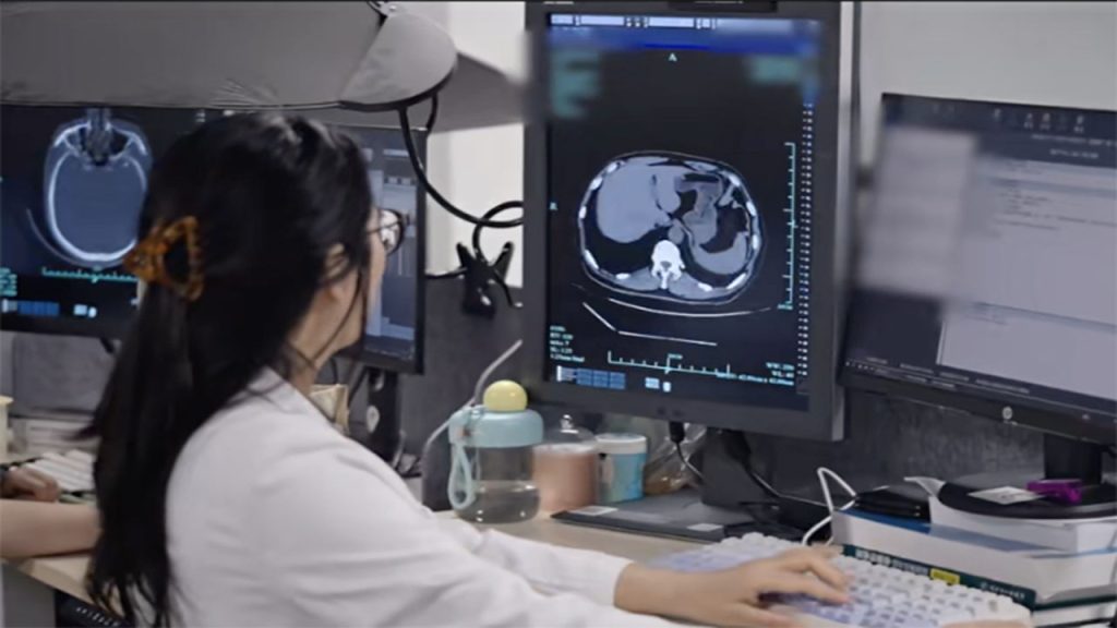 Alibaba Damo Radar Ai Model Detects Diseases Cancer Ct Scans